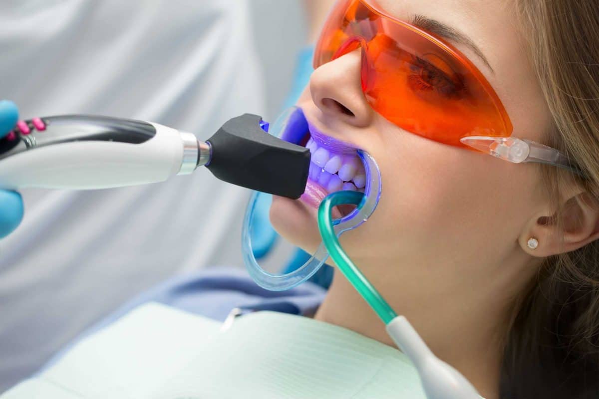 comofuncionaelprocesodeblanqueamientodental