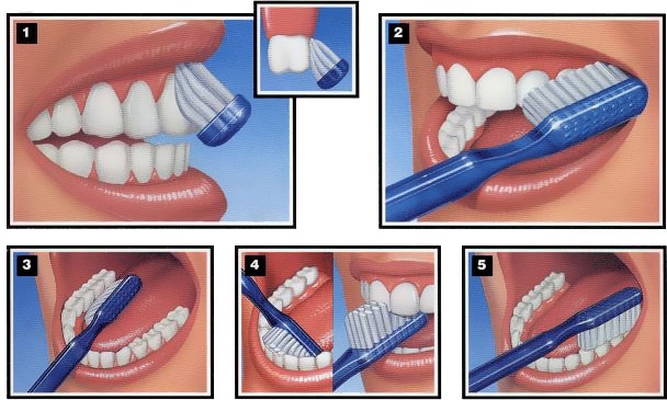 Guía paso a paso: Cepillado dental correcto