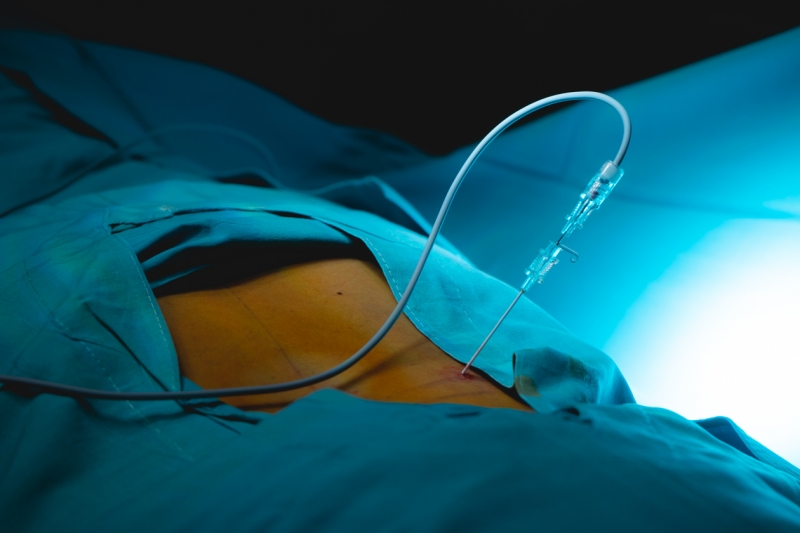 ¿Qué son las Técnicas Mínimamente Invasivas (TMI) en Odontología?