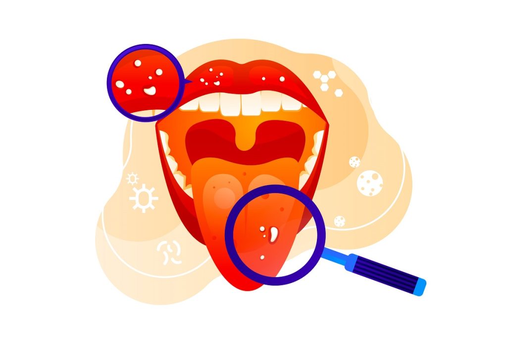 ¿Cómo Afecta la Salud Bucal al Sistema Inmunológico?