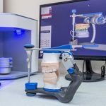 Cómo el CAD/CAM mejora la fabricación de restauraciones dentales