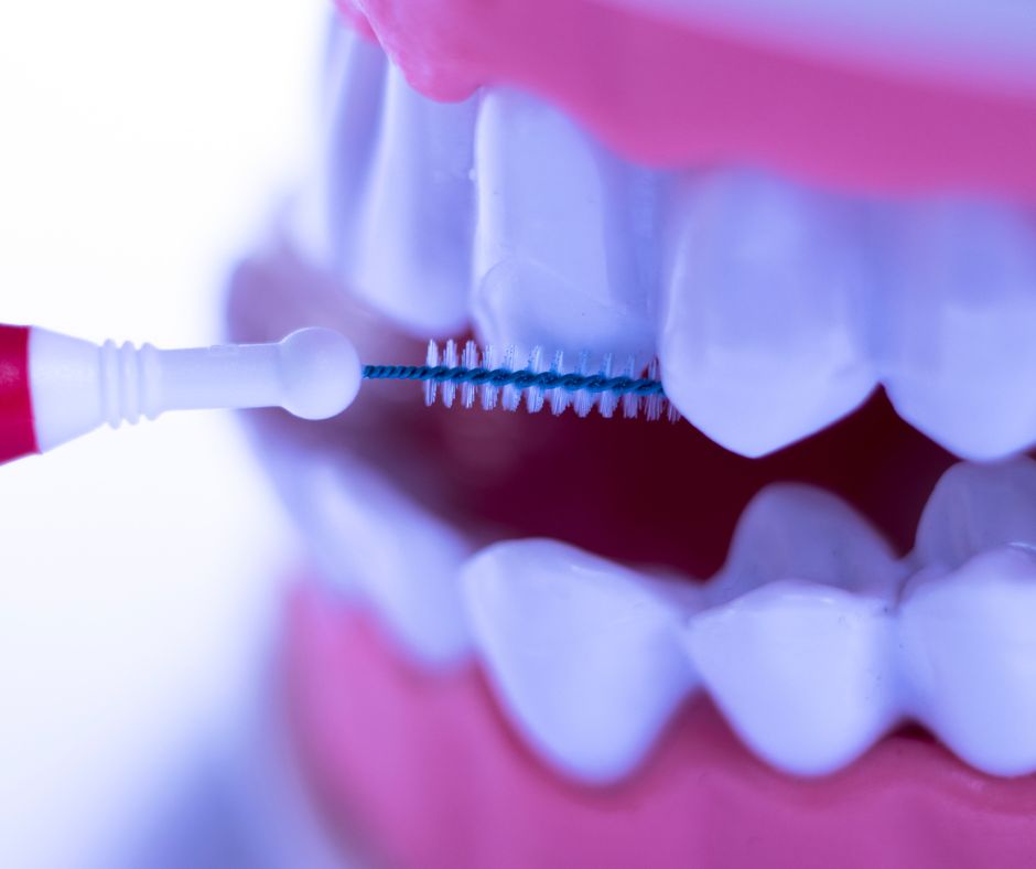 ¿Cómo elegir el cepillo interdental adecuado?