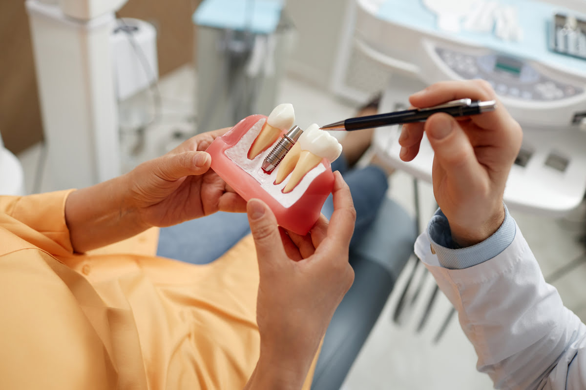 Costos de los Implantes Dentales