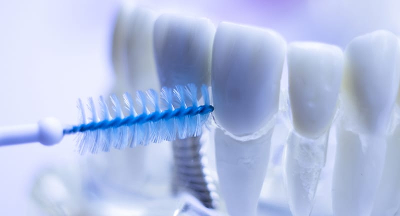 Estudios y datos relevantes sobre el uso del cepillo interdental