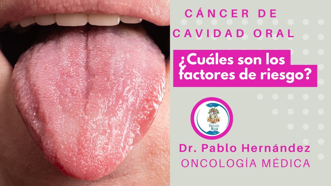 Factores de Riesgo Asociados al Cáncer Oral