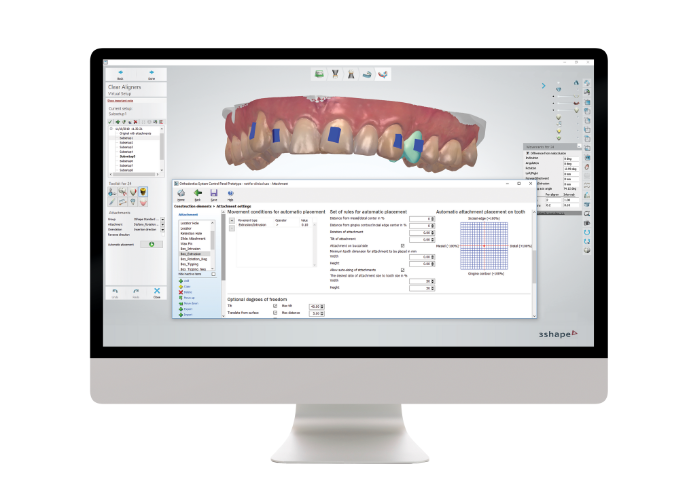 Tecnología CAD/CAM en odontología restauradora