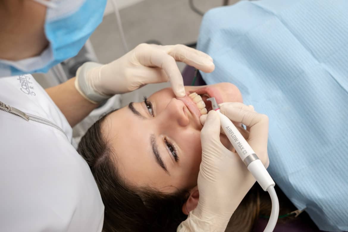 ¿Por Qué Elegí el Blanqueamiento Dental Profesional?
