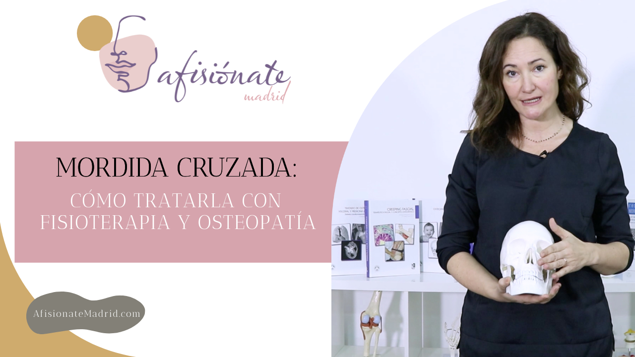 ¿Qué es la Mordida Cruzada y por qué tratarla?