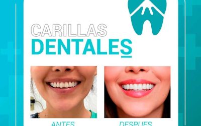 testimoniodepacienteconcarillasdentalesestet