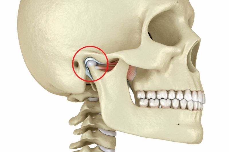 Tratamientos para Trastornos de la Articulación Temporomandibular (ATM)