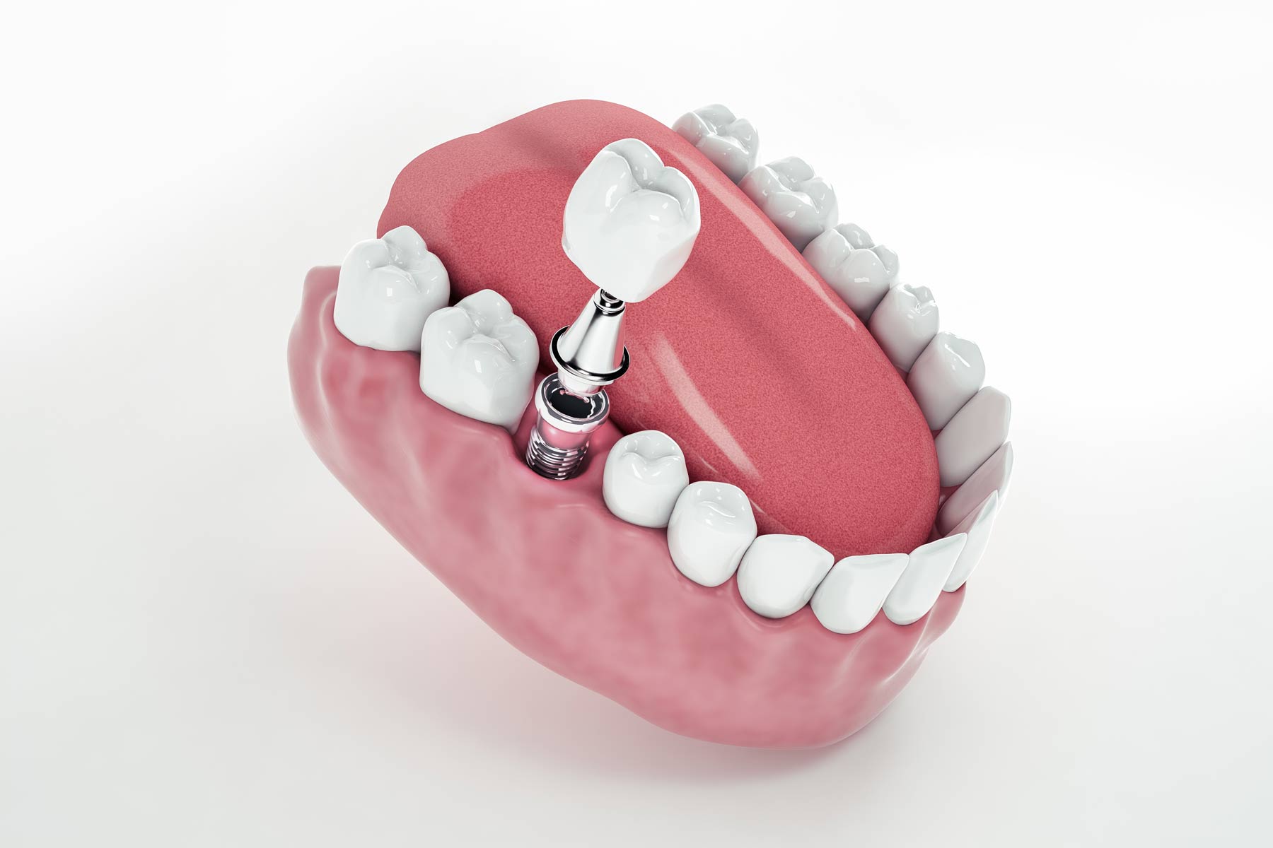 El Rol del Profesional Dental