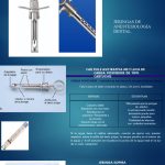 Innovaciones en anestesia dental para mayor confort