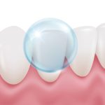 Por qué el flúor es esencial en la prevención dental