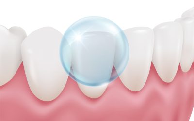 porqueelfluoresesencialenlaprevenciondent