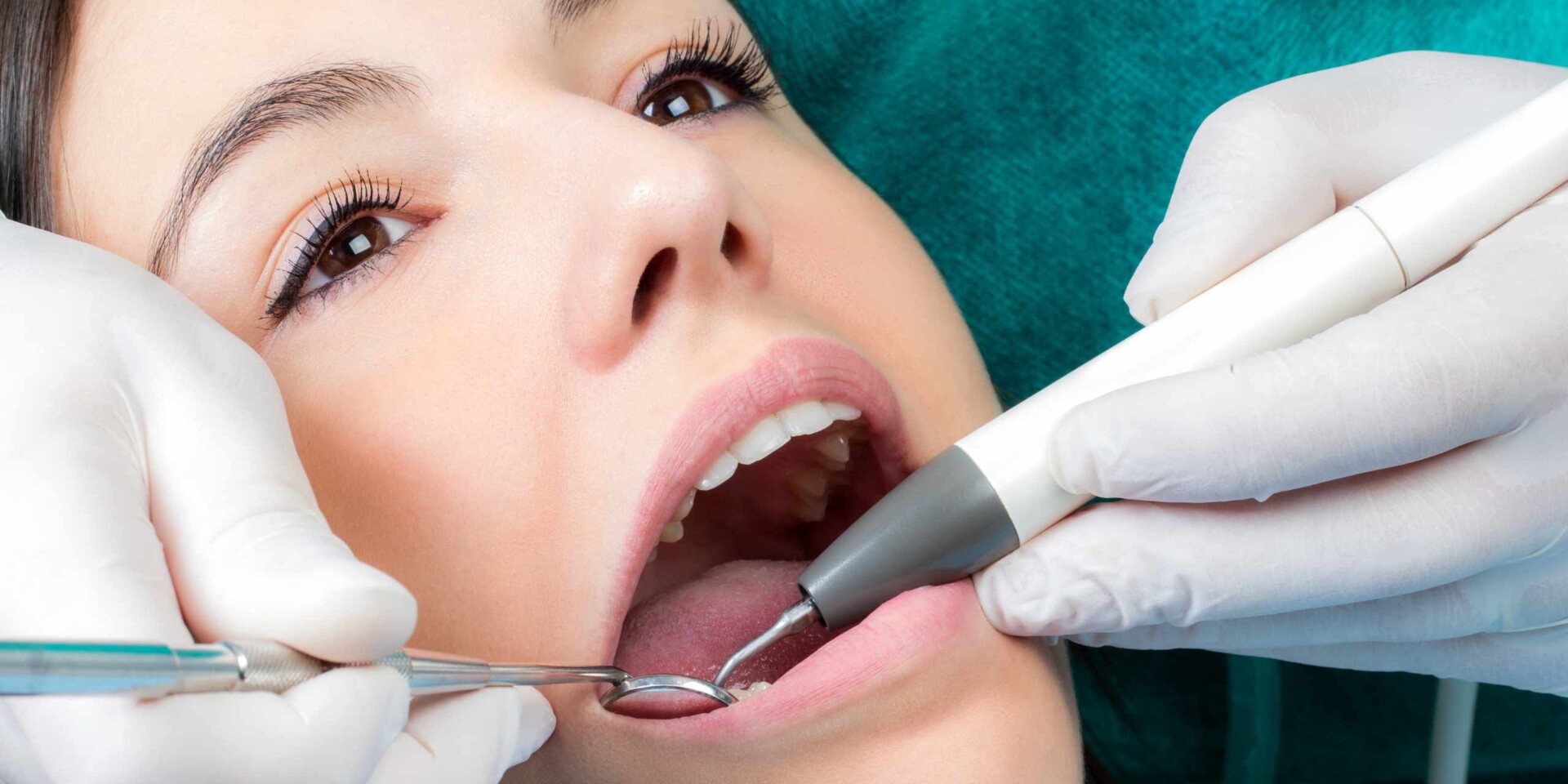 ¿Qué esperar durante una limpieza dental?