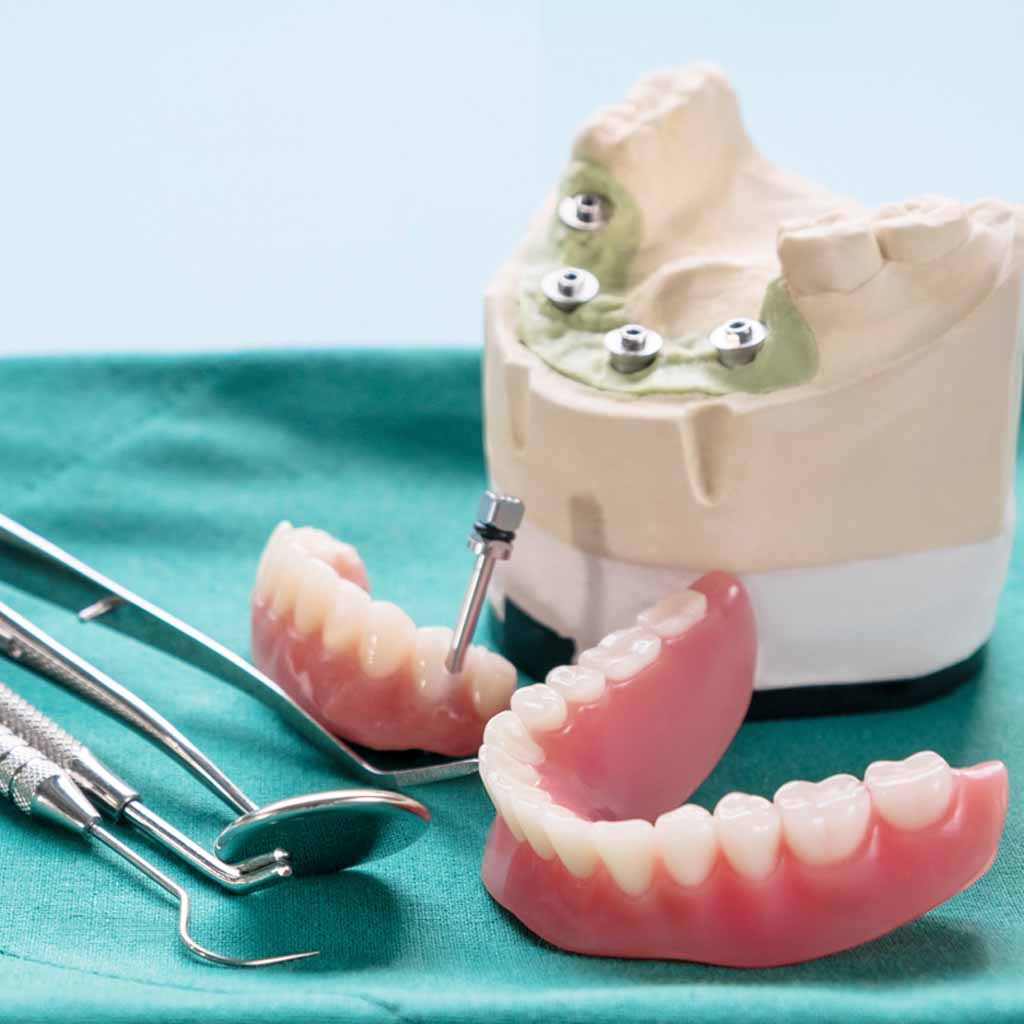 El Inicio de mi Problema Dental