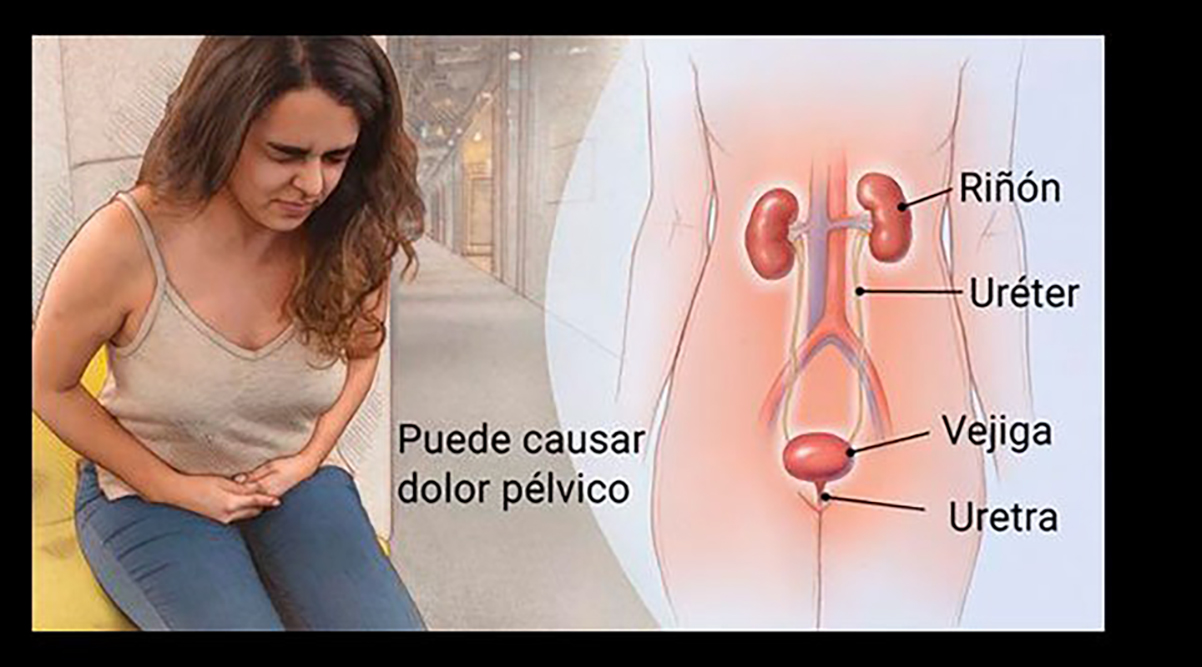 La prevención de caries en personas con diabetes 1 ¿Por qué las personas con diabetes son más propensas a las caries?