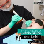 Testimonio: la importancia de la limpieza dental regular
