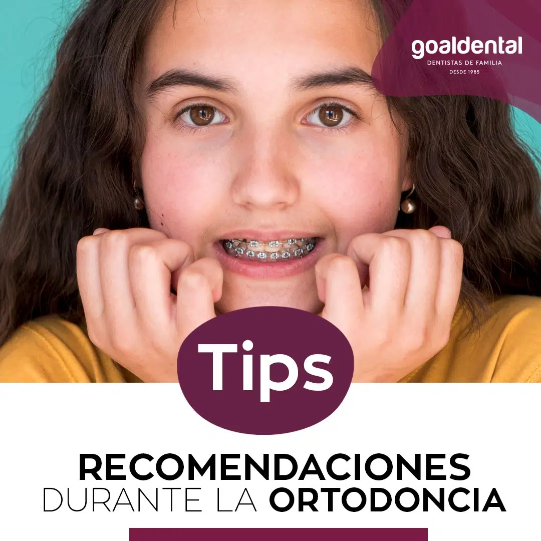 Alimentación Adecuada Durante el Tratamiento de Ortodoncia