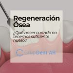 Avances en la regeneración ósea para implantes dentales
