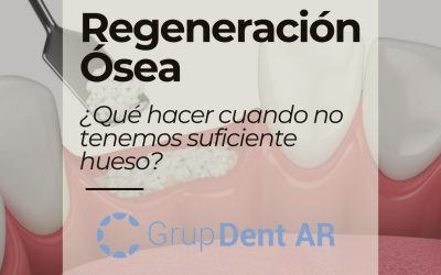 avancesenlaregeneracionoseaparaimplantesden