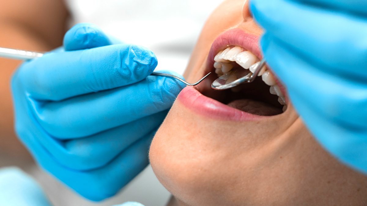 Consejos para evitar la inflamación de encías 3 Cuándo consultar a un dentista
