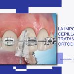 Cuidados dentales para pacientes con ortodoncia
