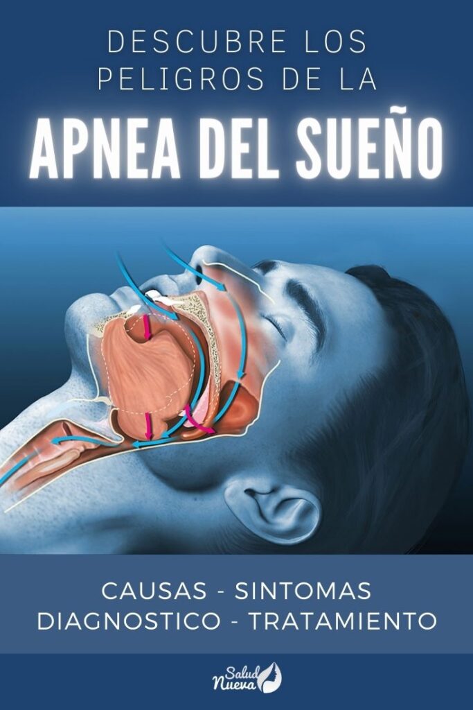 ¿Por qué la odontología en el tratamiento de la apnea del sueño?