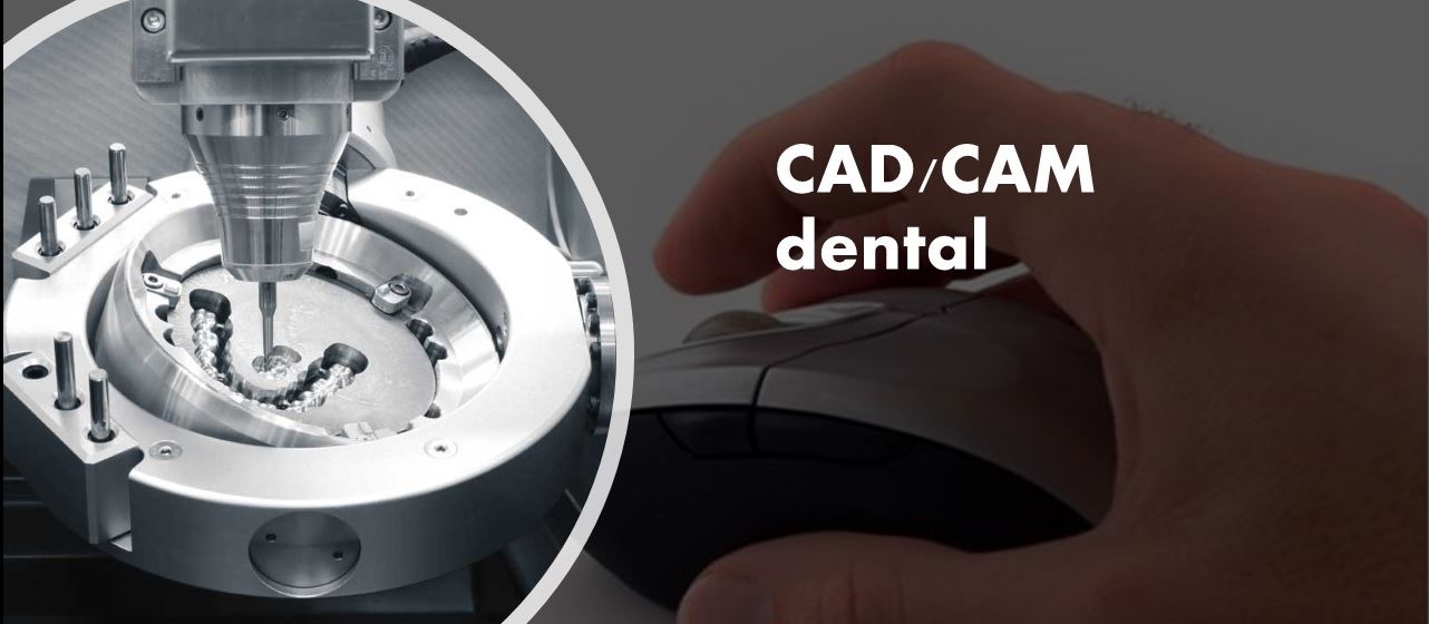 Prótesis Dentales Asistidas por CAD/CAM