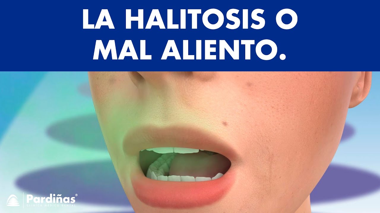 3. Mal Aliento Persistente (Halitosis)