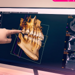 Cómo la odontología digital facilitó mi tratamiento