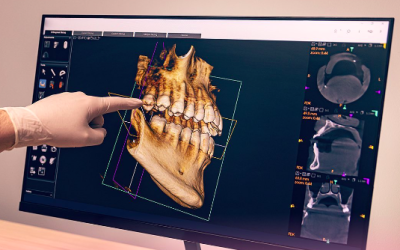 comolaodontologiadigitalfacilitomitratamient