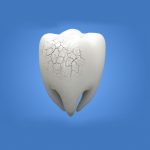 Cuidados para evitar la erosión dental por ácidos