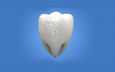 cuidadosparaevitarlaerosiondentalporacidos