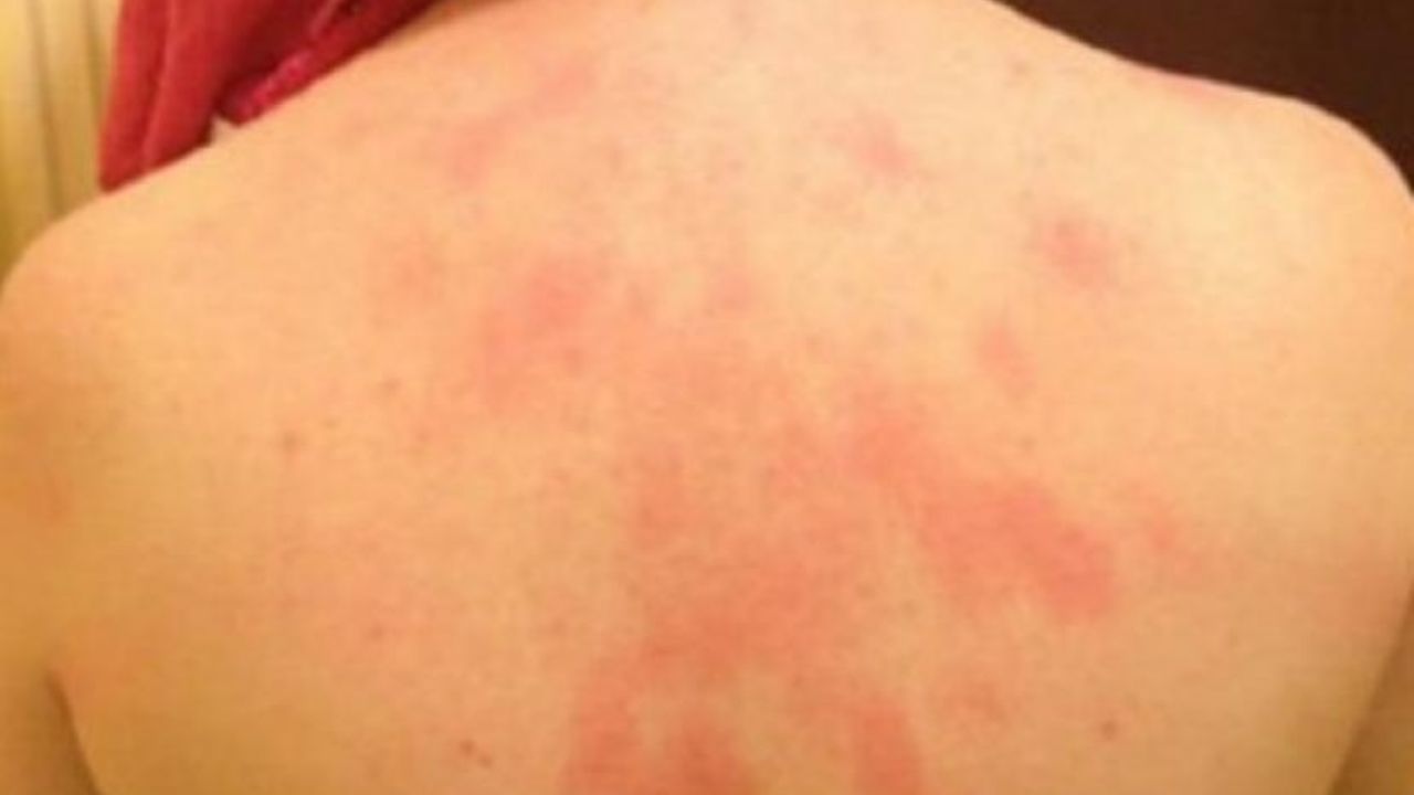 Cómo un tratamiento de conducto salvó mi sonrisa 1 El Inicio del Problema: El Dolor Insoportable
