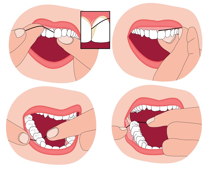 El Uso del Hilo Dental