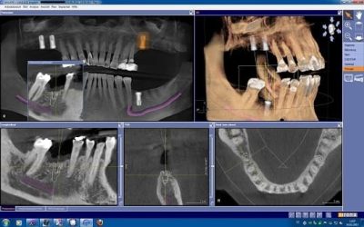 herramientasdigitalesparalaplanificaciondeim