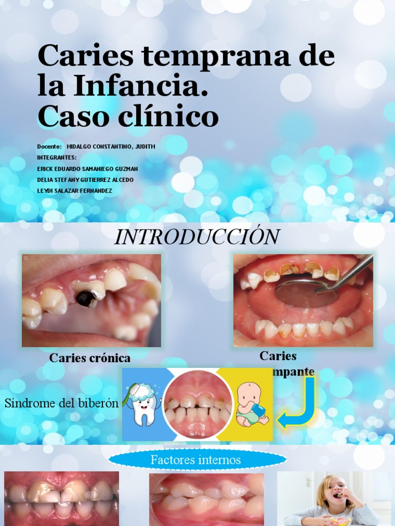 La importancia de la prevención temprana de la caries