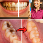 Métodos naturales para fortalecer el esmalte dental