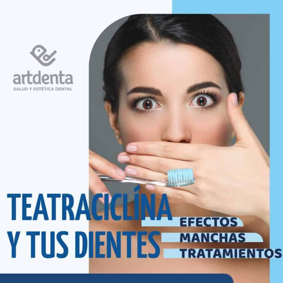 Tratamiento para dientes con manchas oscuras o tetraciclina 1 ¿Qué causa las manchas de tetraciclina?