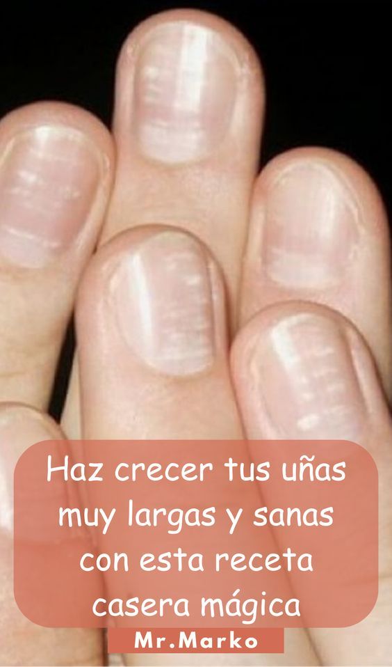Remedios caseros para un esmalte más fuerte