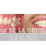 Testimonio: el impacto de la ortodoncia en adultos