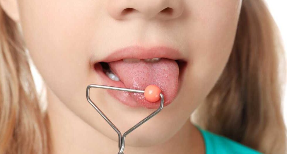 Terapia miofuncional: qué es, para qué sirve y cómo especializarse profesionalmente 3 Terapia miofuncional niña lengua