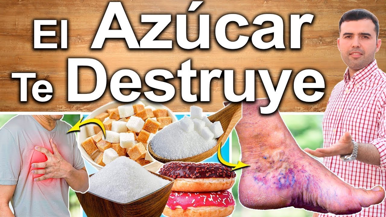 Cómo influye el consumo de azúcar en tus dientes 1 ¿Cómo el Azúcar Causa Caries?