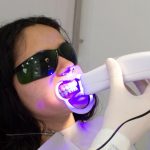 Experiencia con blanqueamiento dental casero supervisado
