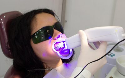 experienciaconblanqueamientodentalcaserosuper
