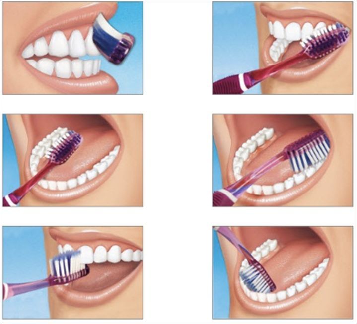 Guía Paso a Paso para un Cepillado Dental Eficaz