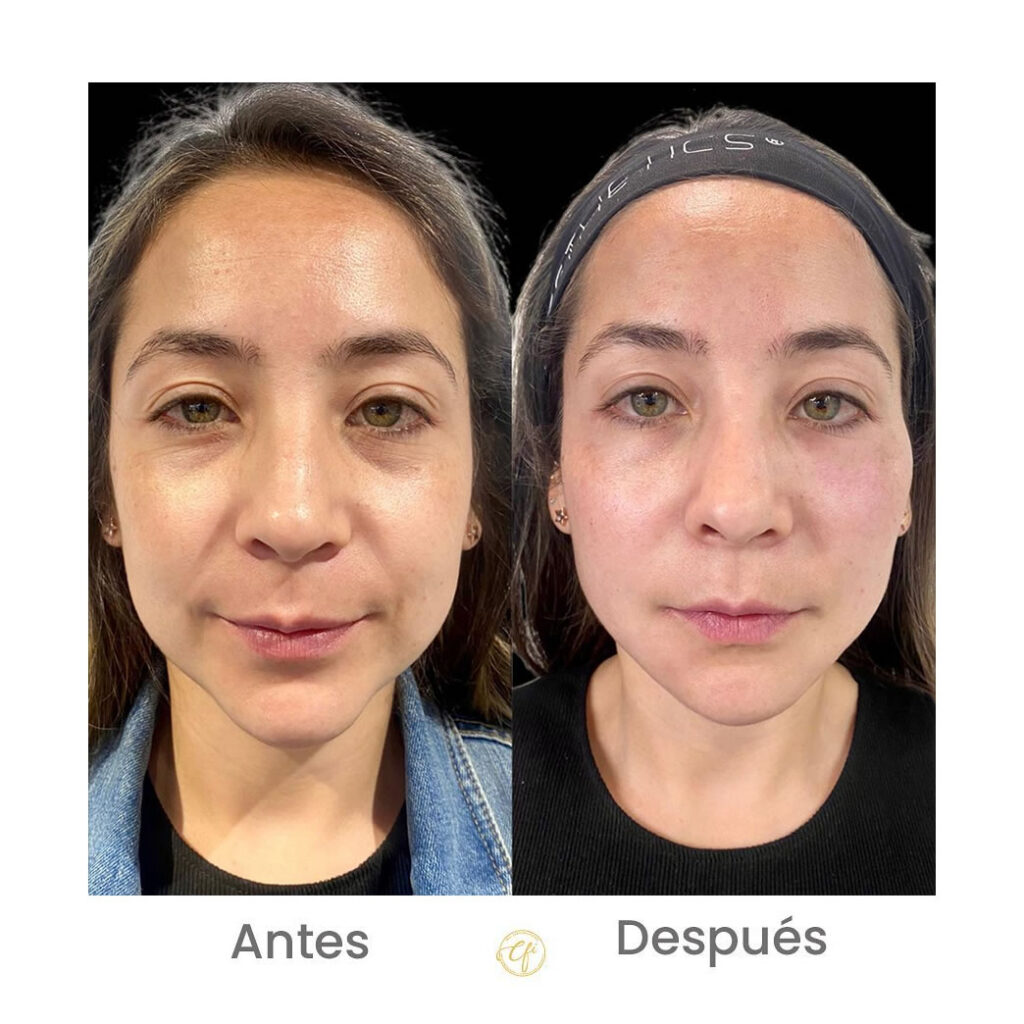 Testimonio sobre la importancia de la prevención en salud dental 1 La Experiencia de Ana: Un Antes y un Después