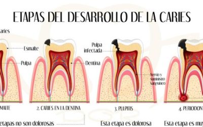 laprevenciondecariesenadultosmayores 698ad66