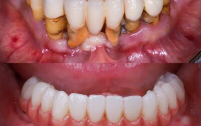 tratamientointegralparalaenfermedadperiodonta